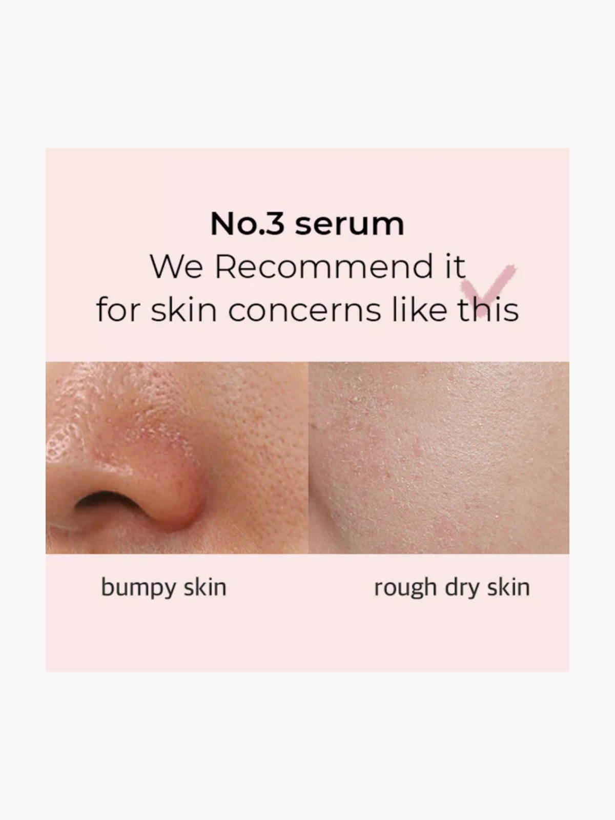 No.3 Skin Softening Serum