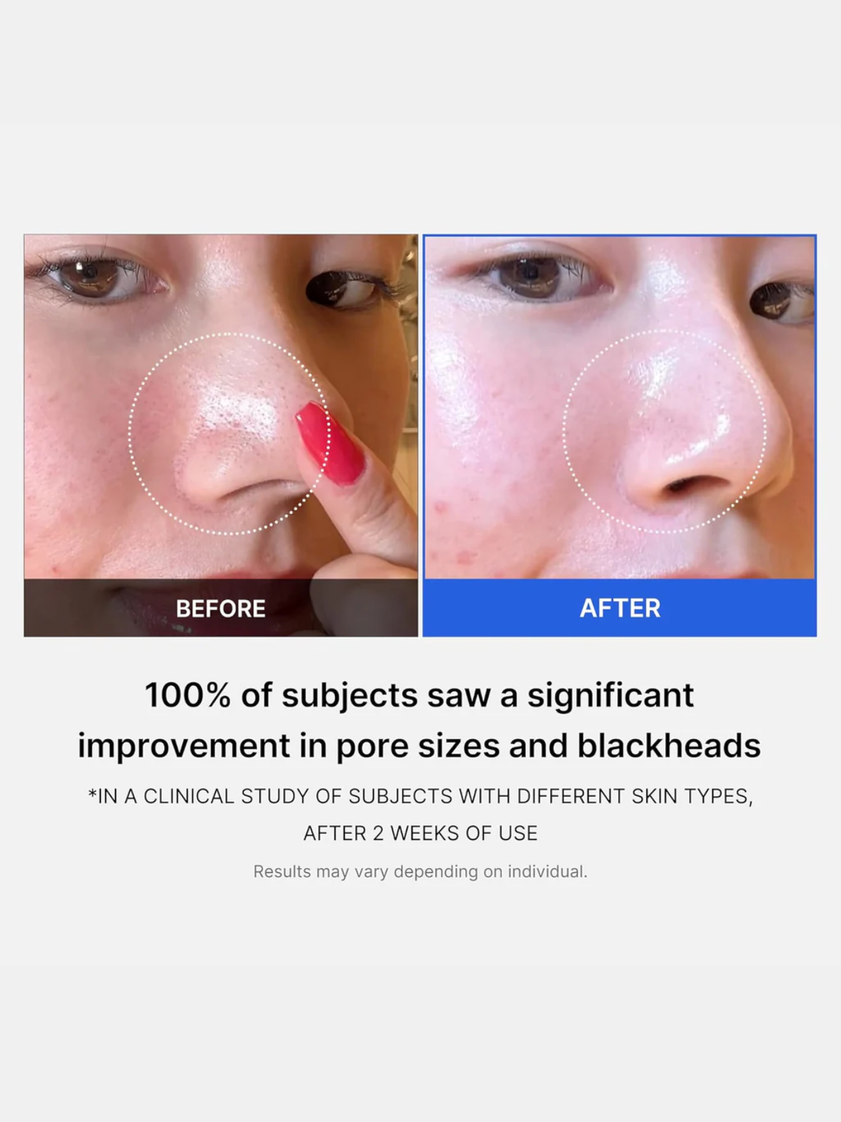 Zero Pore Pad 2.0