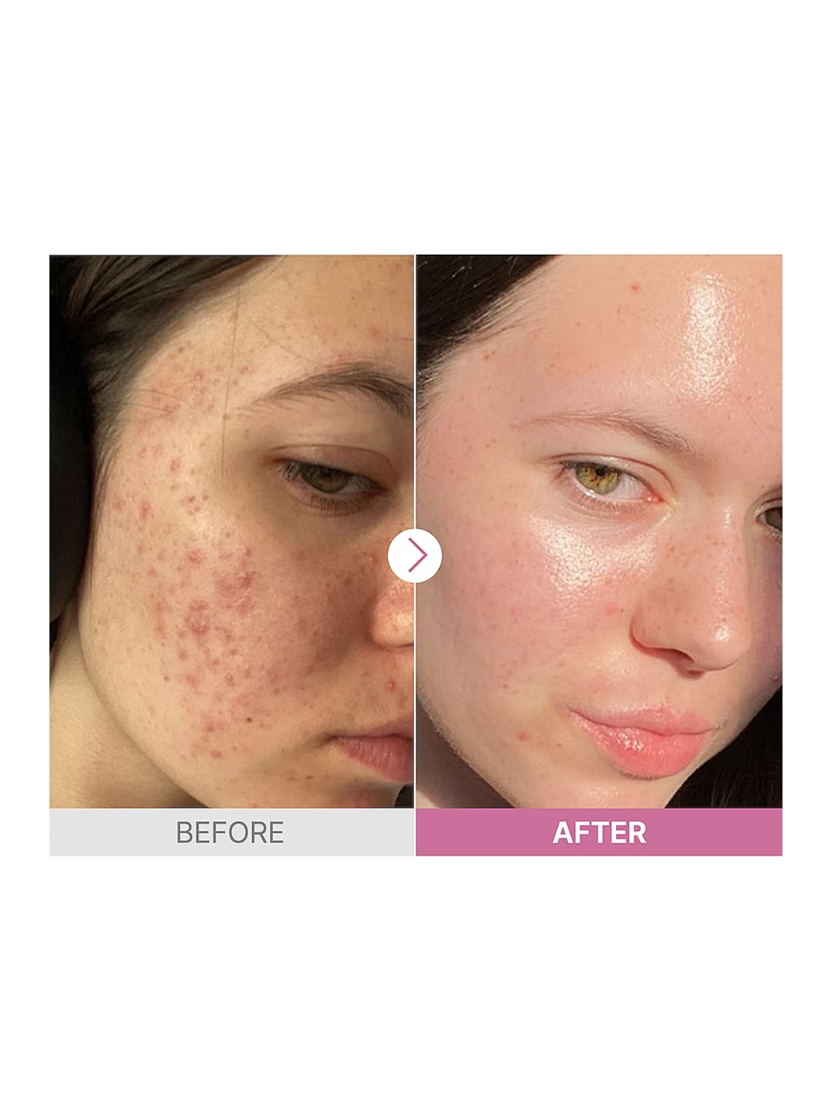 The Niacinamide 15 Serum