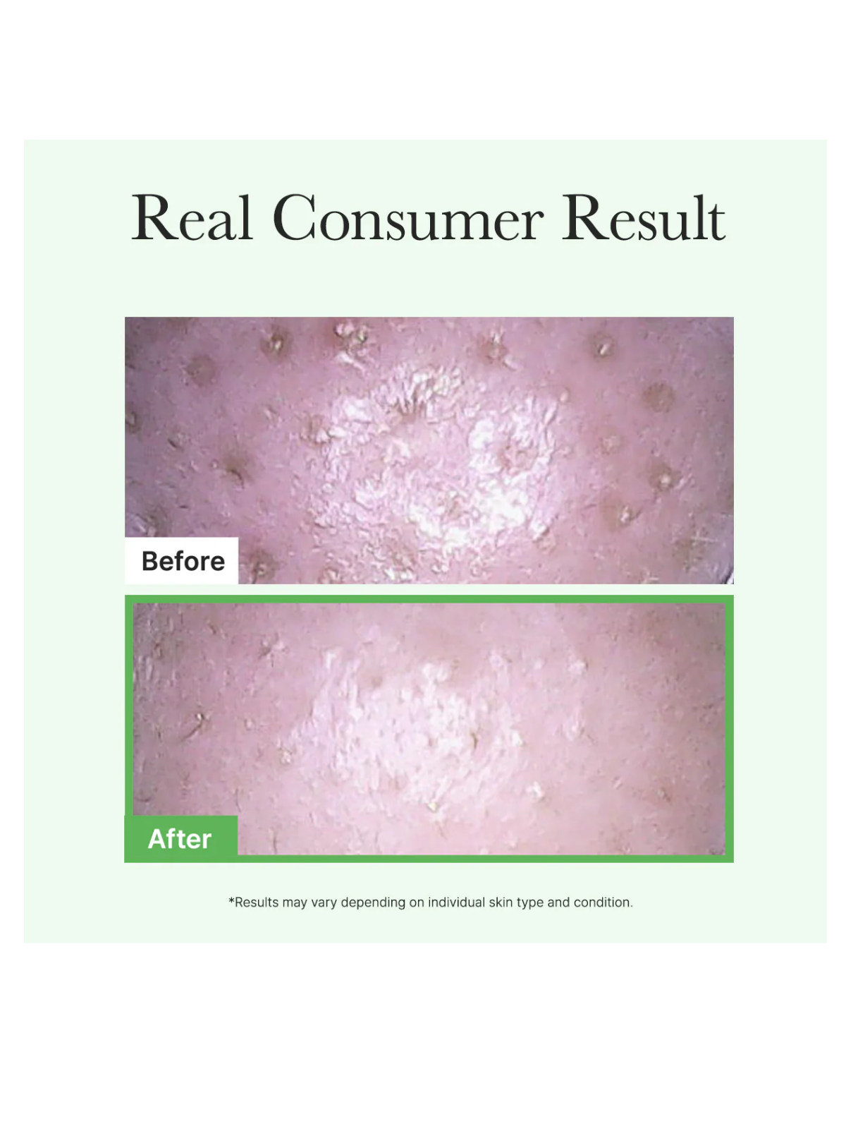 Pore Melt Mochi Cleansing Oil