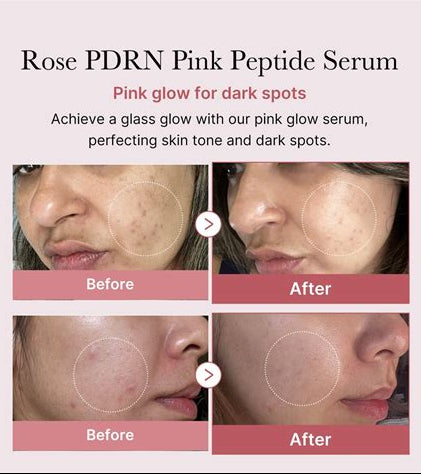 PDRN Pink Peptide Serum